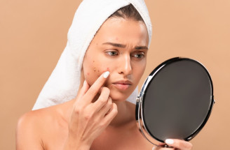 Beauty poradňa GERnétic: Ošetrenie kožných nedokonalostí - AKNÉ
