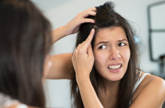 Ako zabrániť šediveniu vlasov? Objav recept starovekej Číny