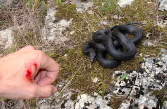Toto potrebuješ vedieť: Vieš, čo robiť po uštipnutí hadom?