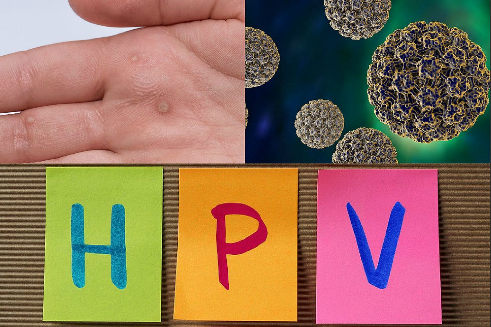 HPV