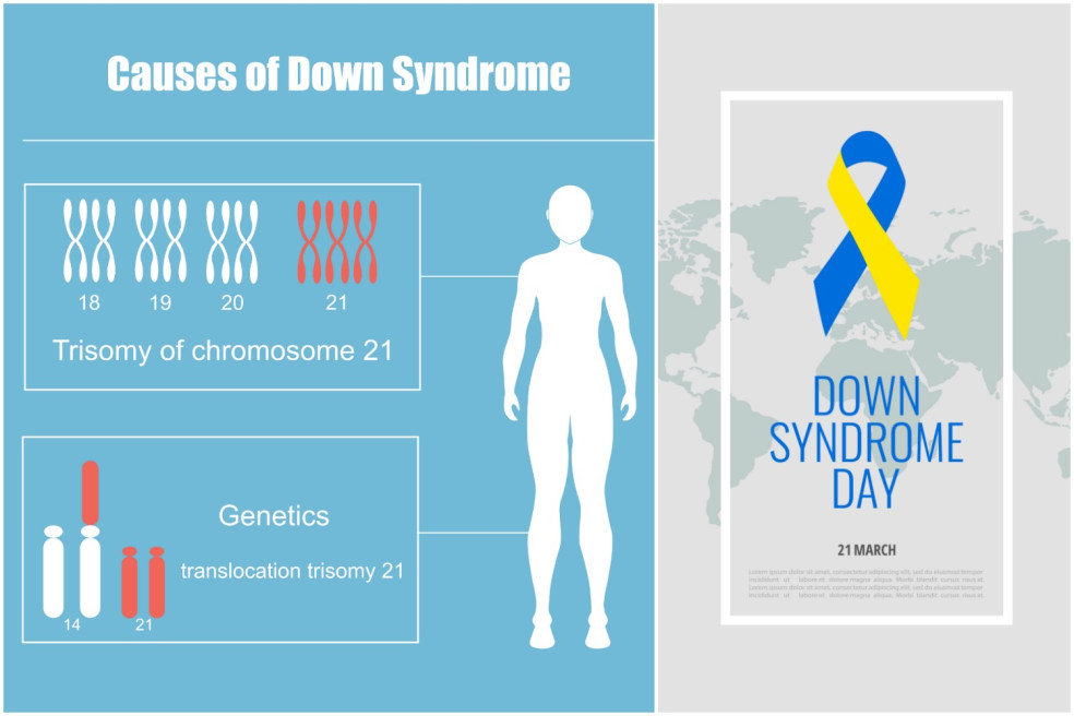 Svetový deň Downovho syndrómu