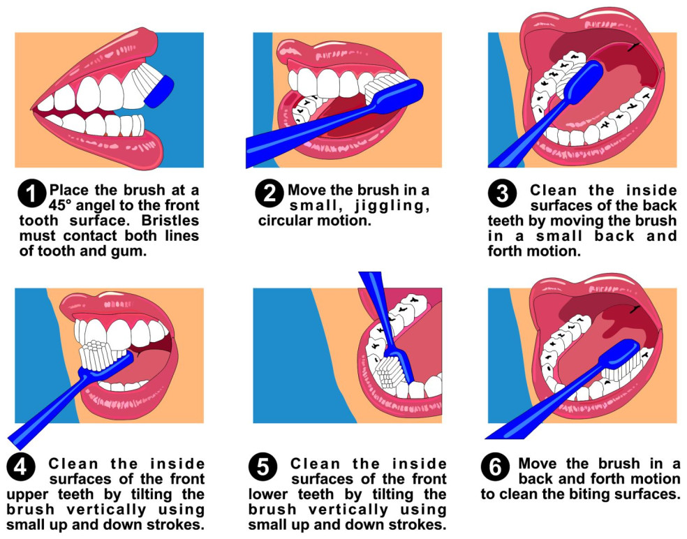 spravna technika cistenie zubov