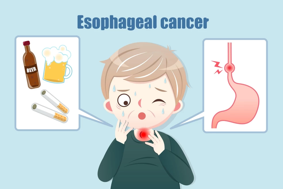проявления рака пищевода