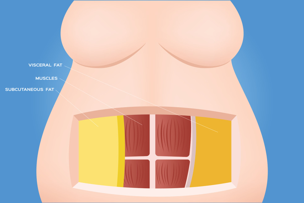 kde je viscerálny tuk