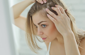 Ako zastaviť vypadávanie vlasov? Tieto fakty ťa prekvapia!