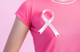 Rakovina prsníka a 7 mýtov s ňou spojených – čo je pravda a čo nie?