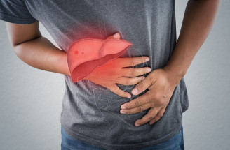 Takto sa prejavuje cirhóza pečene. Aká je však prevencia ochorenia?