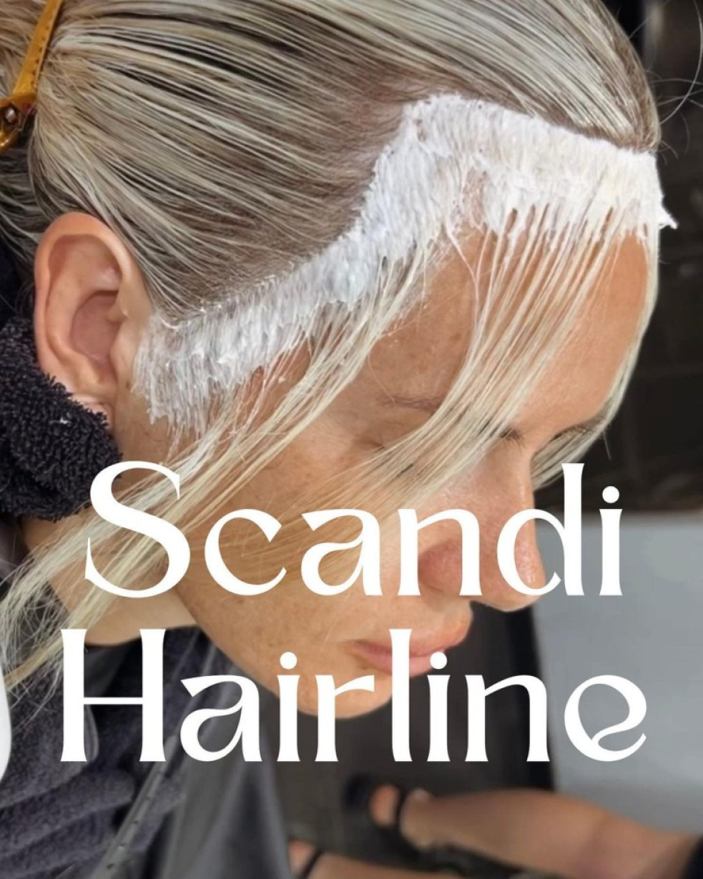 scandinavian hairline