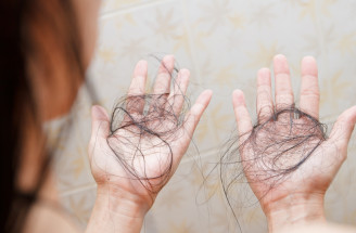 TOP produkty proti vypadávaniu vlasov: Účinné prípravky, ktoré fungujú