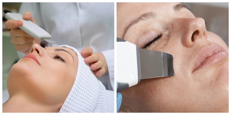 ultrazvuk, ultrazvukové čistenie, hĺbkové čistenie pleti, peeling ultrazvukom, sonoforéza, vstrebávanie látok