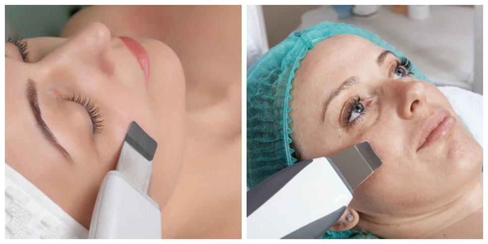 ultrazvuk, ultrazvukové čistenie, hĺbkové čistenie pleti, peeling ultrazvukom, sonoforéza, vstrebávanie látok