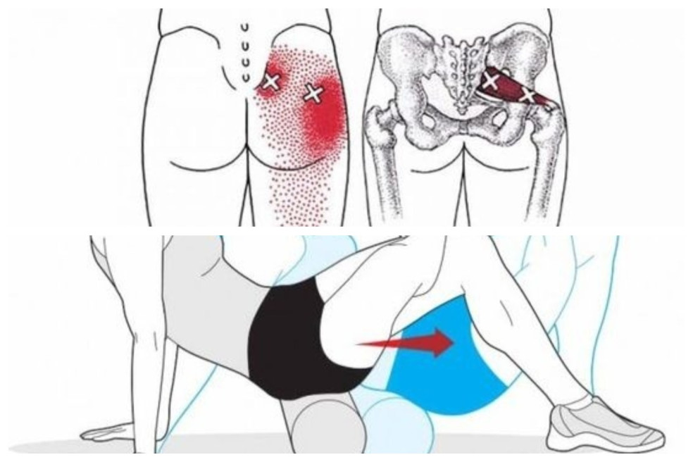 piriformis sval