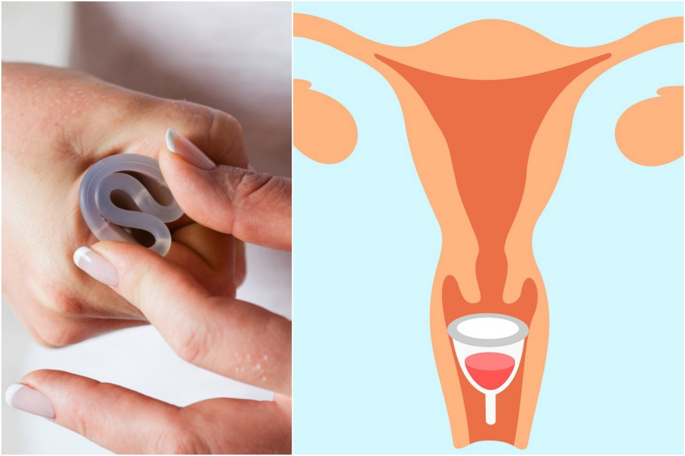 zavádzanie menštruačného kalíška