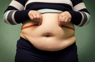 Najväčšie mýty o obezite: Môžu všetci obézni za svoju diagnózu?!