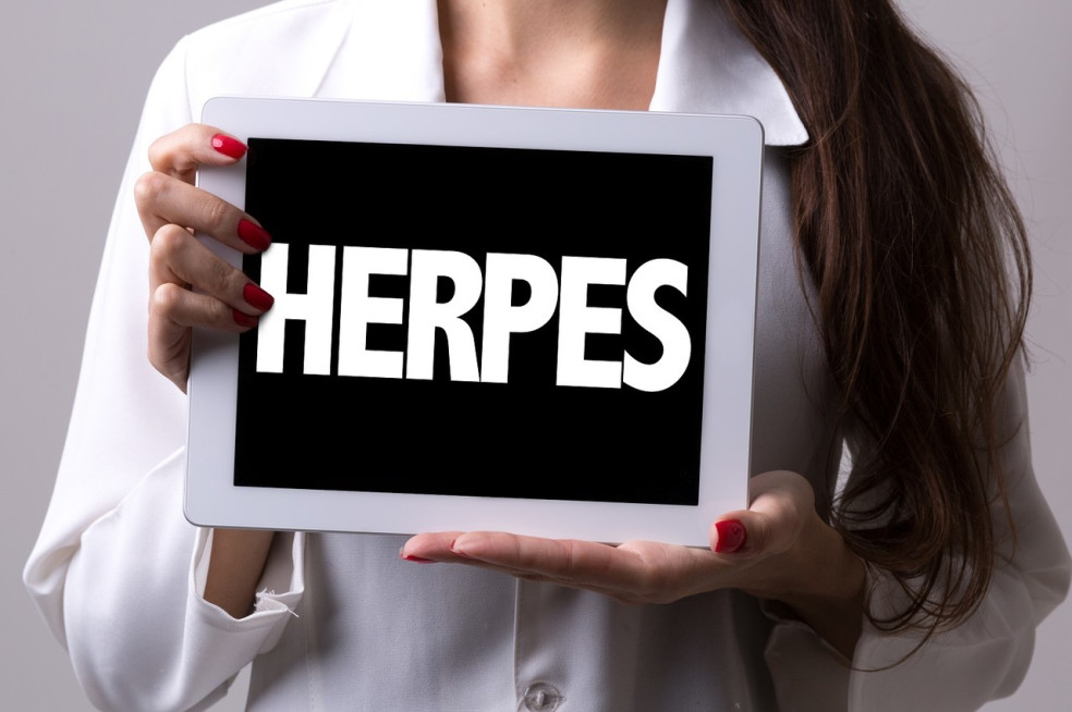 herpes