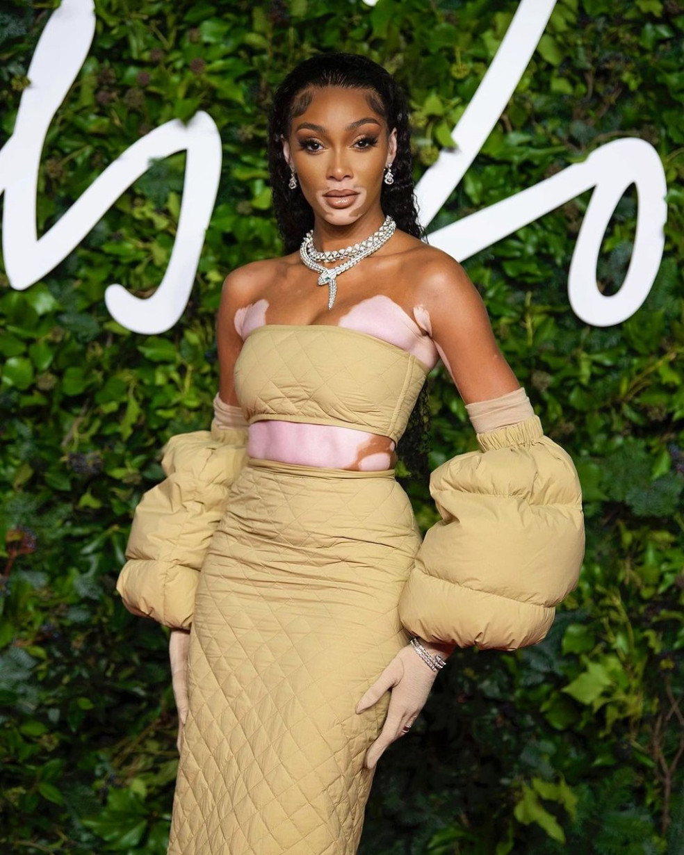 Winnie Harlow
