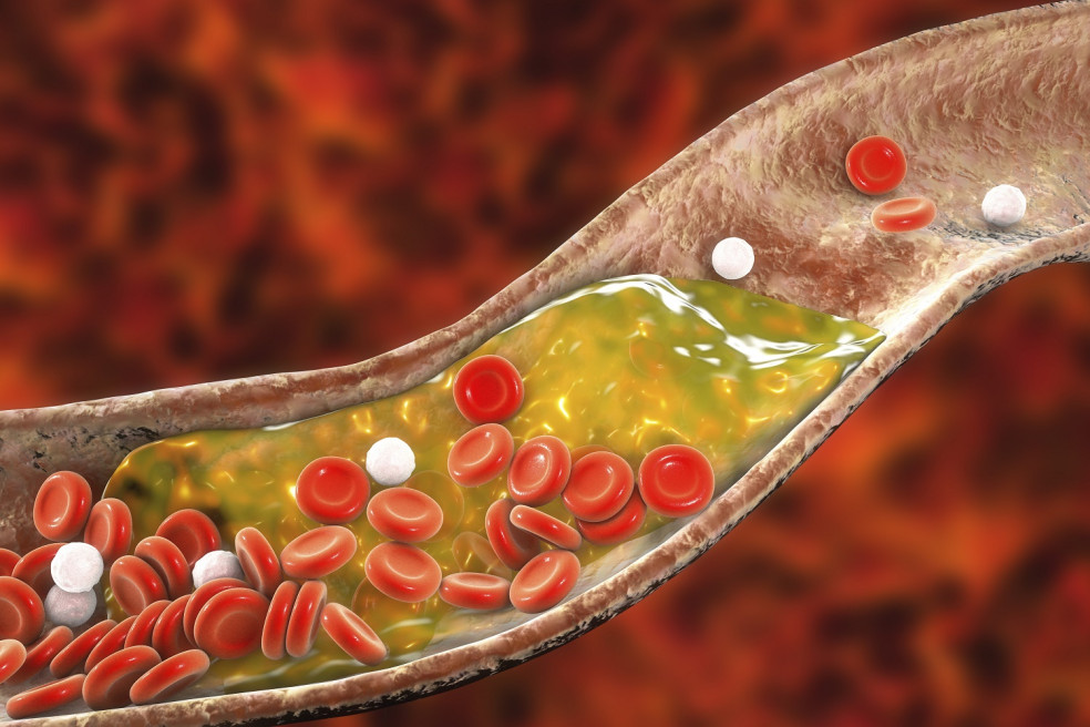 cholesterol