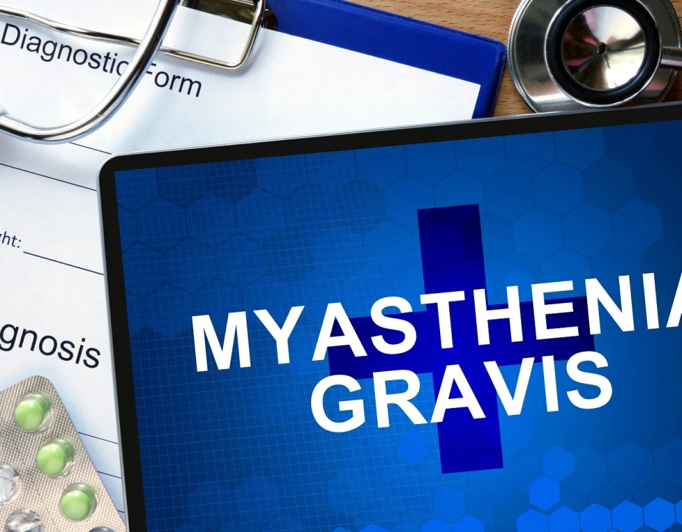 Myasthenia gravis príznaky