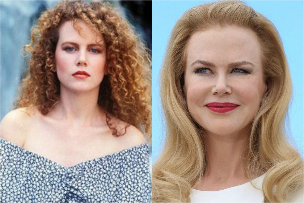 Nicol Kidman