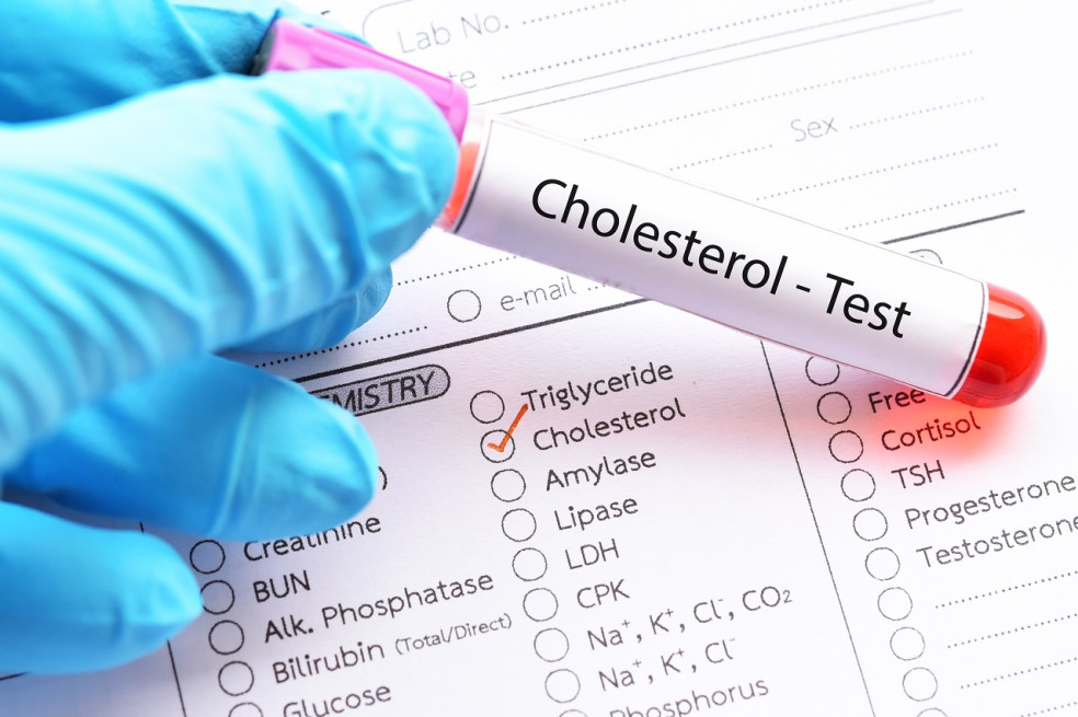 optimálne hodnoty cholesterolu