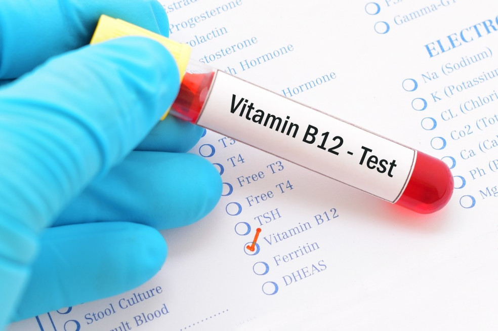 nedostatok vitamínu B12