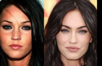 Hollywood stars pred a po plastike