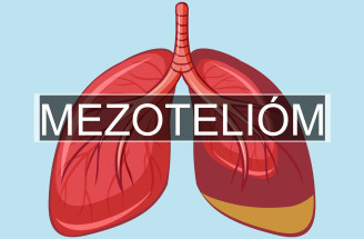 Agresívne a zriedkavé nádorové ochorenie: Kedy vzniká mezotelióm?