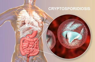 Nepríjemná parazitárna choroba: Aké ťažkosti spôsobuje kryptosporidióza?