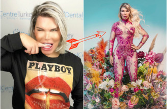 Živý KEN Rodrigo Alves sa mení na BARBIE: Odpadneš z toho, ako vyzerá!