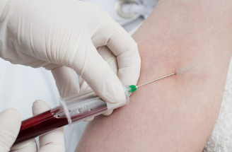 Polycytémia vera – čo môže spôsobiť nadbytok červených krviniek?