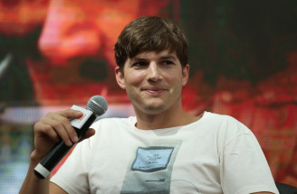Bojuje s ňou aj herec Ashton Kutcher – čo je vaskulitída a aké môže mať prejavy?