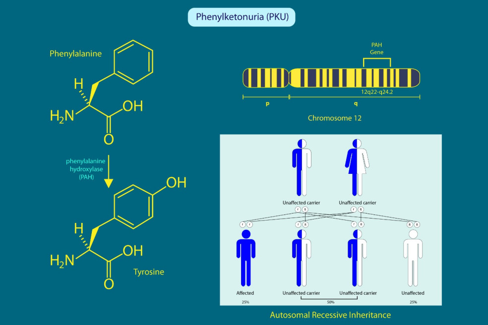 príčiny fenylketonúrie