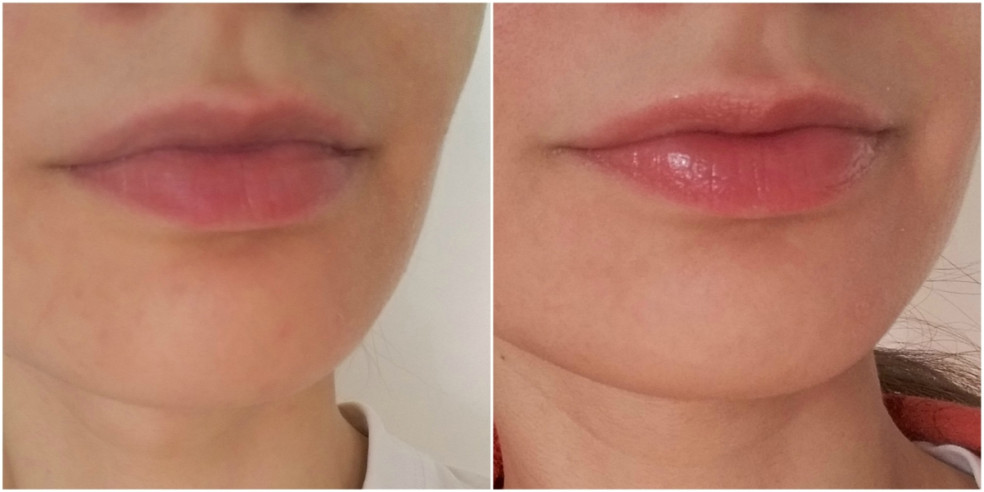 TEST: Pharma Hyaluron – Volume Lip Booster – balzam na zväčšenie objemu pier