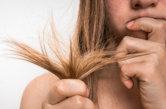 DIY maska na lámavé vlasy: Čo je pre nich zaručenou spásou?