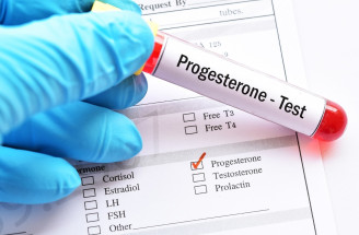 Progesterón – čo všetko je potrebné vedieť o tomto ženskom hormóne?