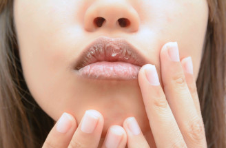 Nestačí ti ani len balzam na suché pery? Vyskúšaj naše tipy!