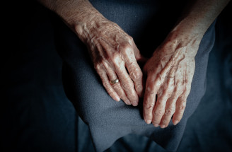 Starostlivosť o pleť nestačí! Ako zastaviť starnutie rúk?