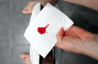 Vedela si, že menštruačná krv má svoje využitie?! Ženy sa asi zbláznili!