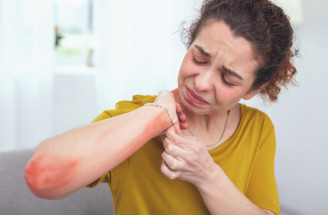 Ako sa prejavuje alergia na kov? Možno ňou trpíš aj ty!
