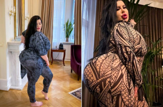 Minula 150 000 dolárov, aby mala najväčší zadok na svete: Má to však svoju daň!