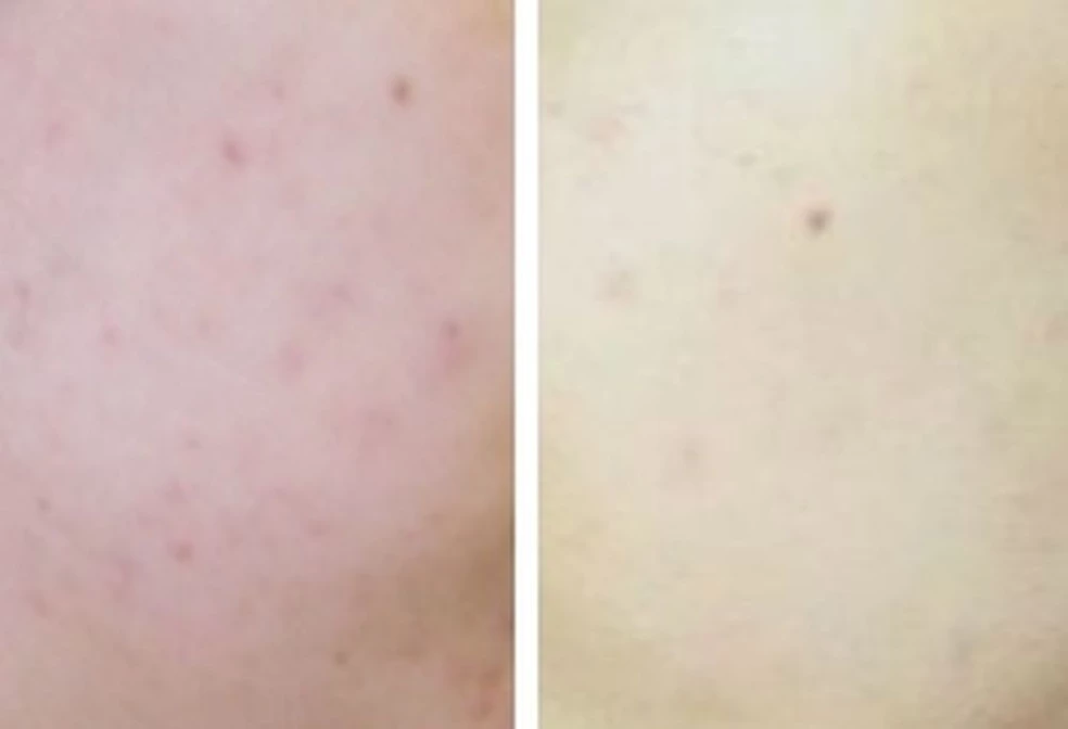 Crema schiarente viso Natura house