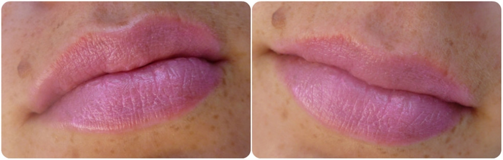 dermacol - love lips balm