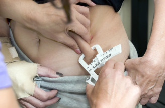 Ako sa zbaviť tuku na brušku: Overené tipy pre ženy každého veku