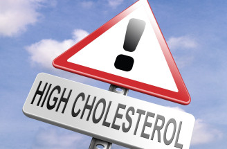 7 zásad, ako znížiť hladinu cholesterolu v krvi – BEZ LIEKOV!