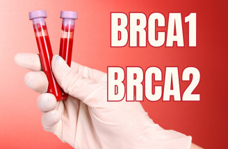 BRCA mutácie – kto je ich nositeľom a riziko ktorých druhov rakoviny zvyšujú?