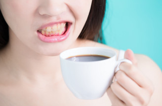 3 najhoršie potraviny pre zuby: Tieto radšej konzumuj s mierou!