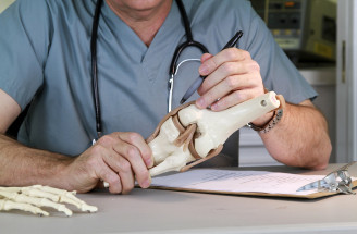 Názor ortopéda na dopĺňanie kolagénu: Aký je význam kolagénu pre kĺby?