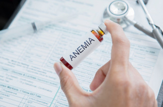 Ako rozpoznať anémiu včas? Neuveríš, ale pozri na svoje viečka!