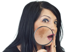 Beauty poradňa GERnétic: Pigmentové škvrny