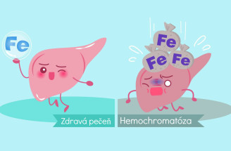 Vieš, čo je hemochromatóza? Následky ochorenia môžu byť trpké!